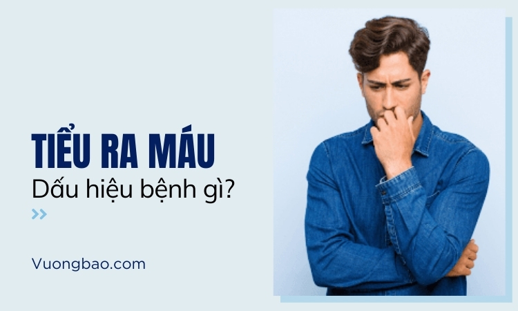 Tiểu ra máu – Dấu hiệu của căn bệnh nguy hiểm nào?