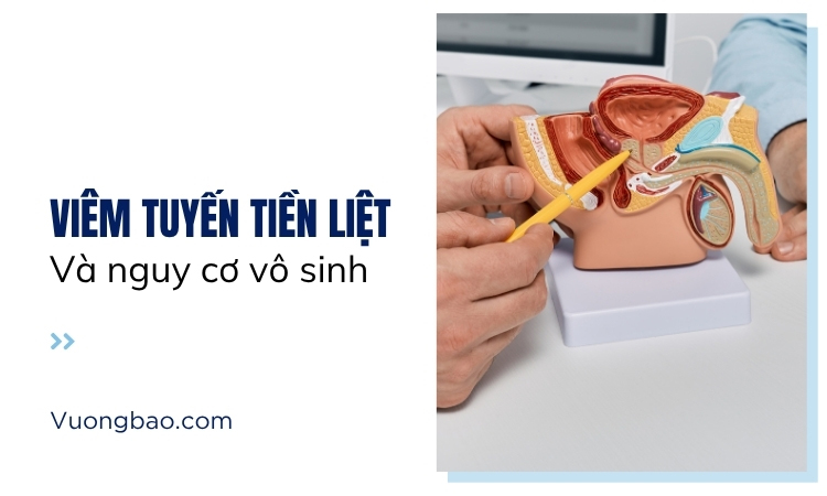 Viêm tuyến tiền liệt và nguy cơ gây vô sinh ở nam giới